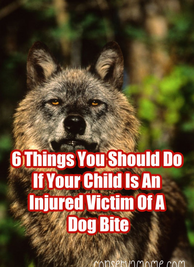 6 Things You Should Do If Your Child Is A Victim Of A Dog Bite