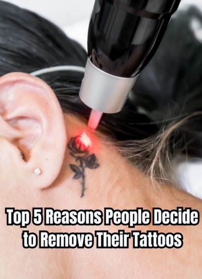 Top 5 Reasons People Decide to Remove Their Tattoos