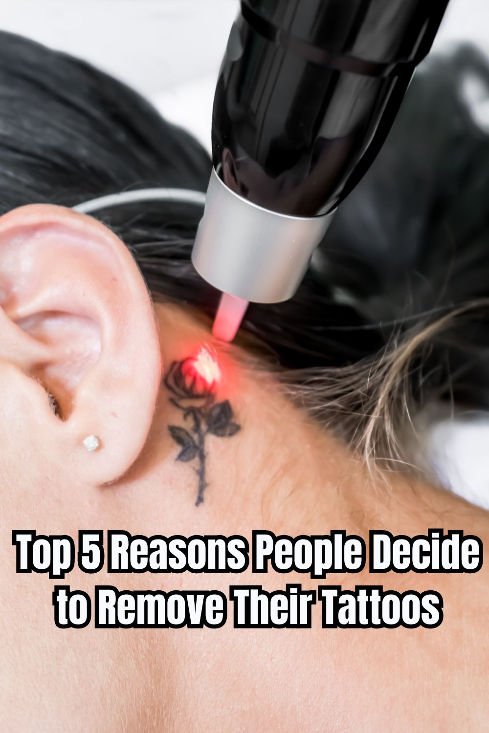 Top 5 Reasons People Decide to Remove Their Tattoos