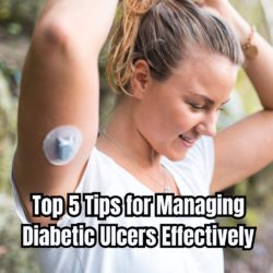 Top 5 Tips for Managing Diabetic Ulcers Effectively