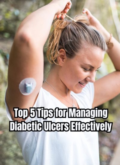 Top 5 Tips for Managing Diabetic Ulcers Effectively