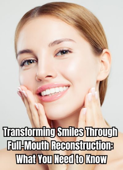 Transforming Smiles Through Full-Mouth Reconstruction What You Need to Know