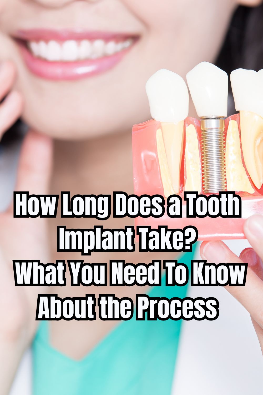 How Long Does a Tooth Implant Take What You Need To Know About the Process