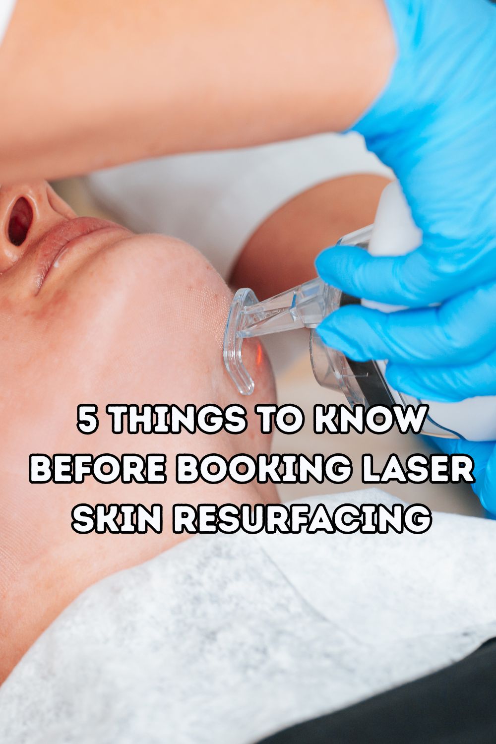 5 Things to Know Before Booking Laser Skin Resurfacing