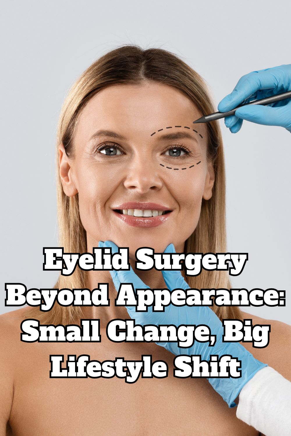 Eyelid Surgery Beyond Appearance Small Change, Big Lifestyle Shift