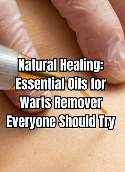 Natural Healing Essential Oils for Warts Remover Everyone Should Try