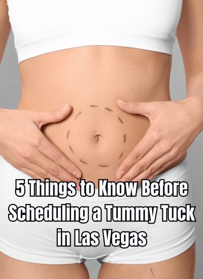 5 Things to Know Before Scheduling a Tummy Tuck in Las Vegas