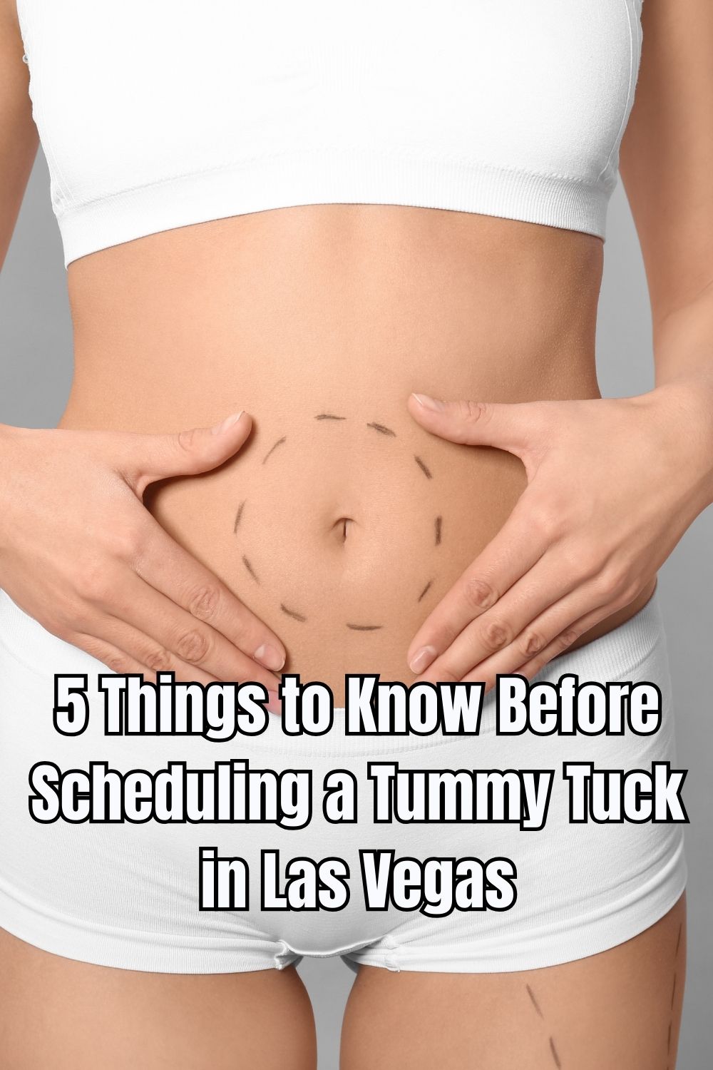5 Things to Know Before Scheduling a Tummy Tuck in Las Vegas