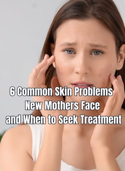 6 Common Skin Problems New Mothers Face and When to Seek Treatment
