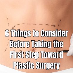 6 Things to Consider Before Taking the First Step Toward Plastic Surgery