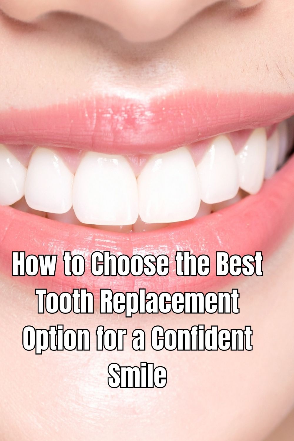 How to Choose the Best Tooth Replacement Option for a Confident Smile