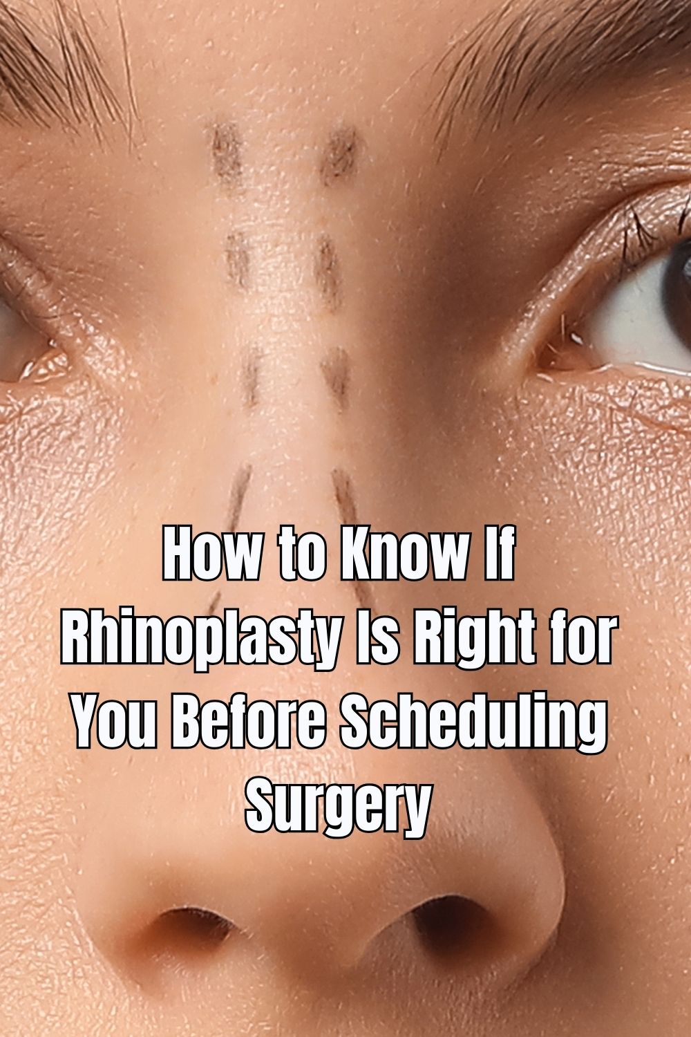 How to Know If Rhinoplasty Is Right for You Before Scheduling Surgery
