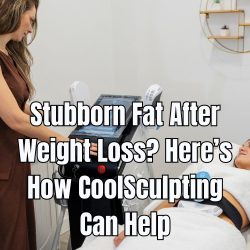 Stubborn Fat After Weight Loss? Here’s How CoolSculpting Can Help