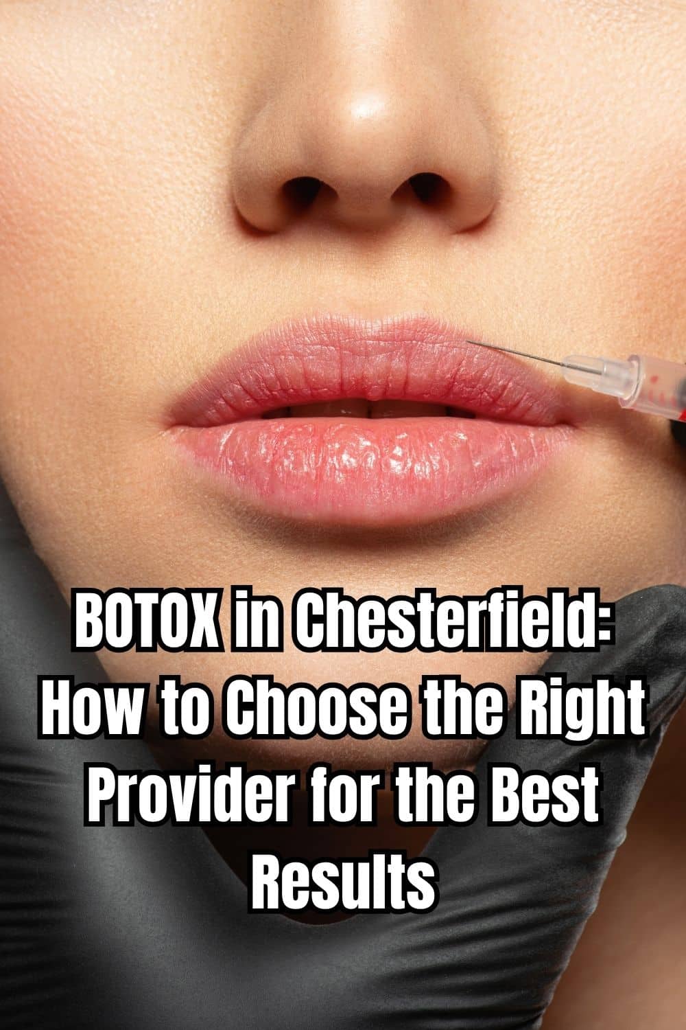 BOTOX in Chesterfield: How to Choose the Right Provider for the Best Results