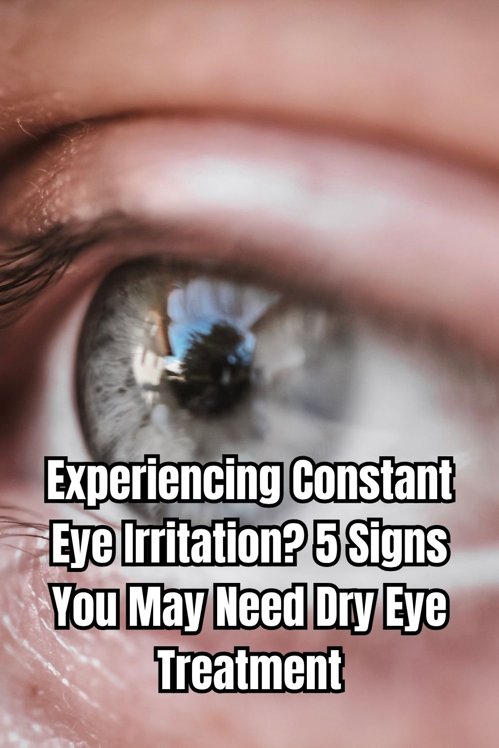Experiencing Constant Eye Irritation 5 Signs You May Need Dry Eye Treatment