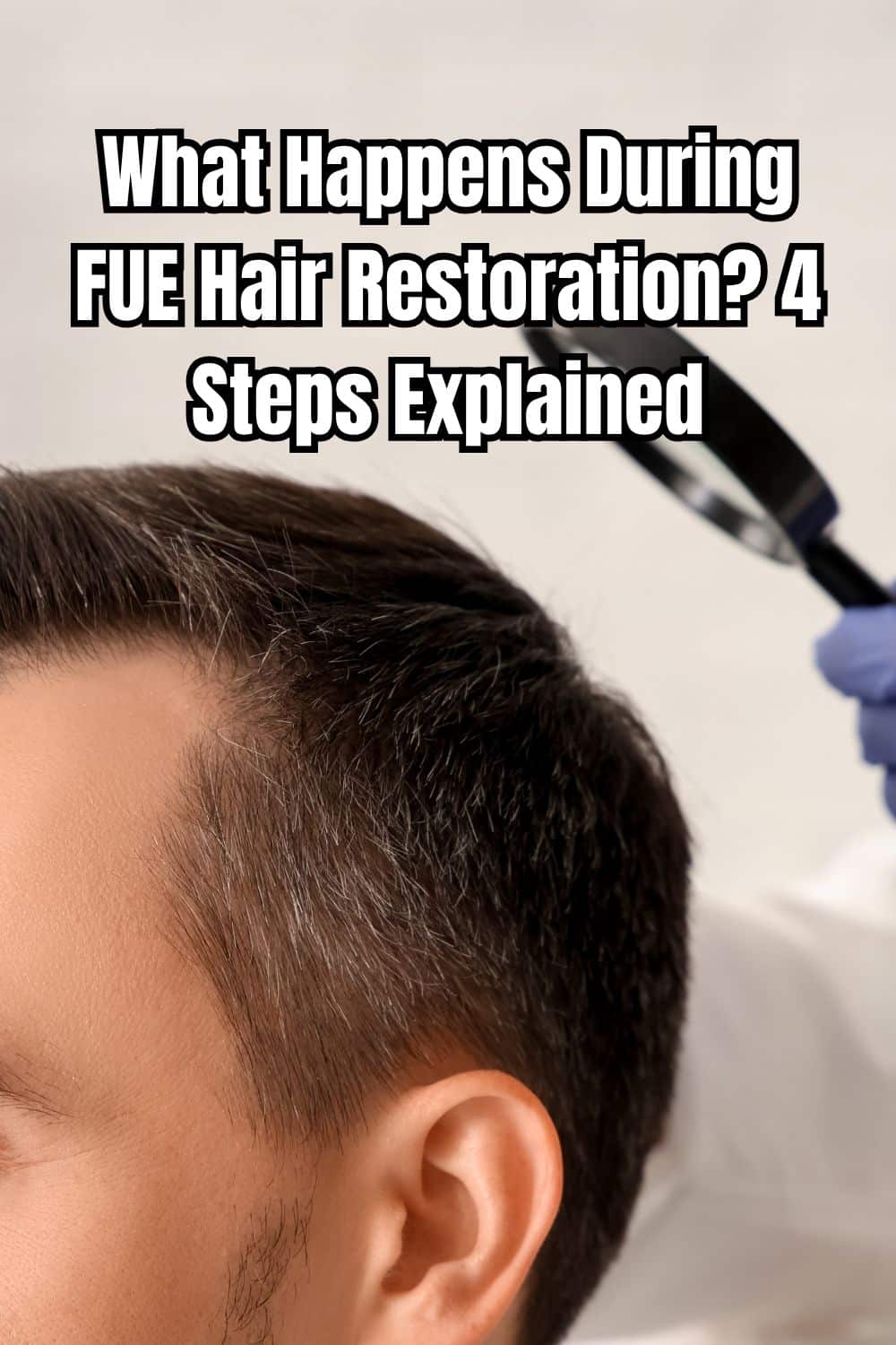 What Happens During FUE Hair Restoration 4 Steps Explained