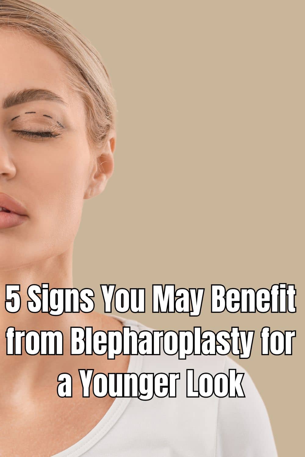 5 Signs You May Benefit from Blepharoplasty for a Younger Look