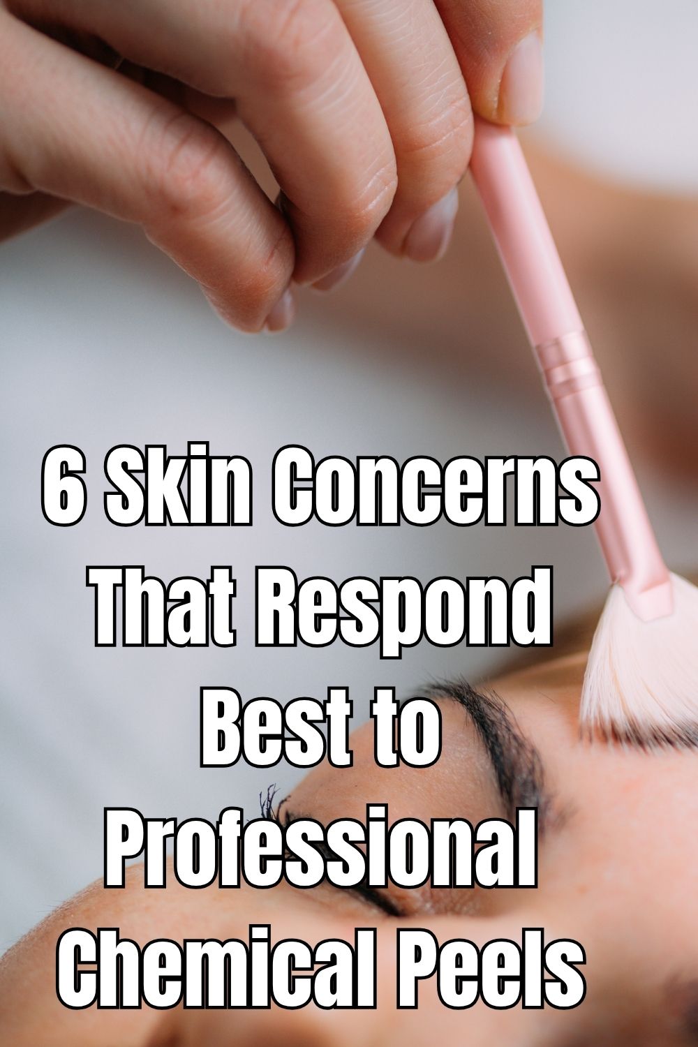 6 Skin Concerns That Respond Best to Professional Chemical Peels