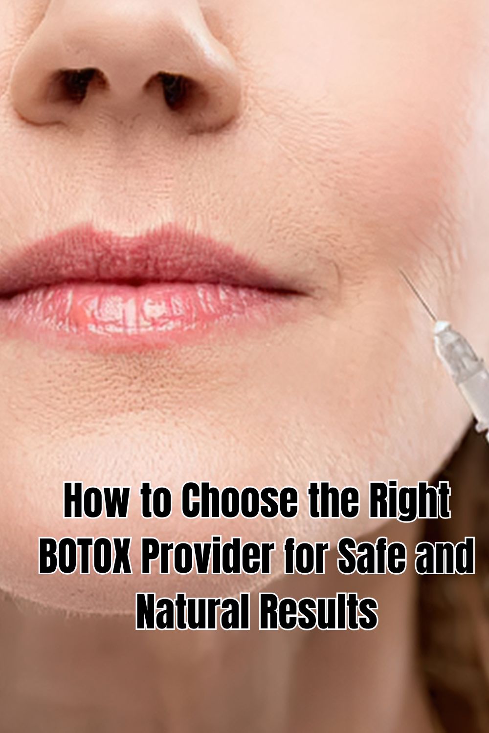 Learn how to choose the right BOTOX provider for safe and natural results by understanding their training and experience.