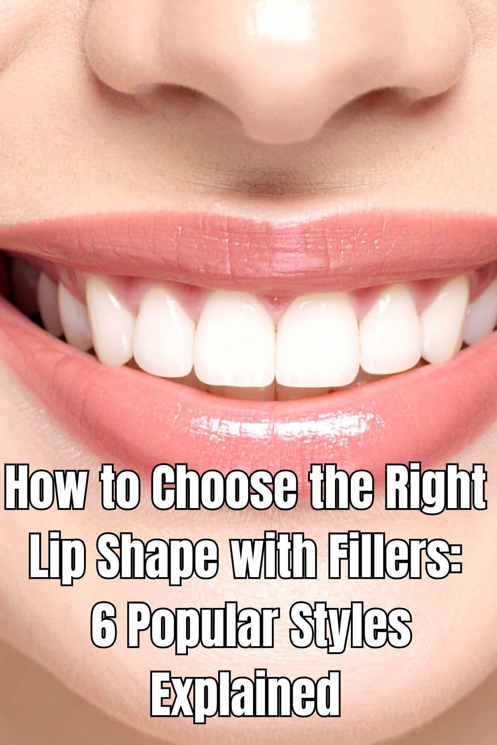 How to Choose the Right Lip Shape with Fillers 6 Popular Styles Explained