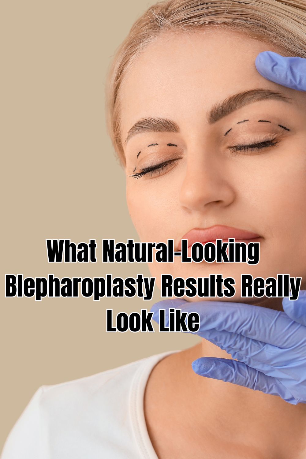 What Natural-Looking Blepharoplasty Results Really Look Like