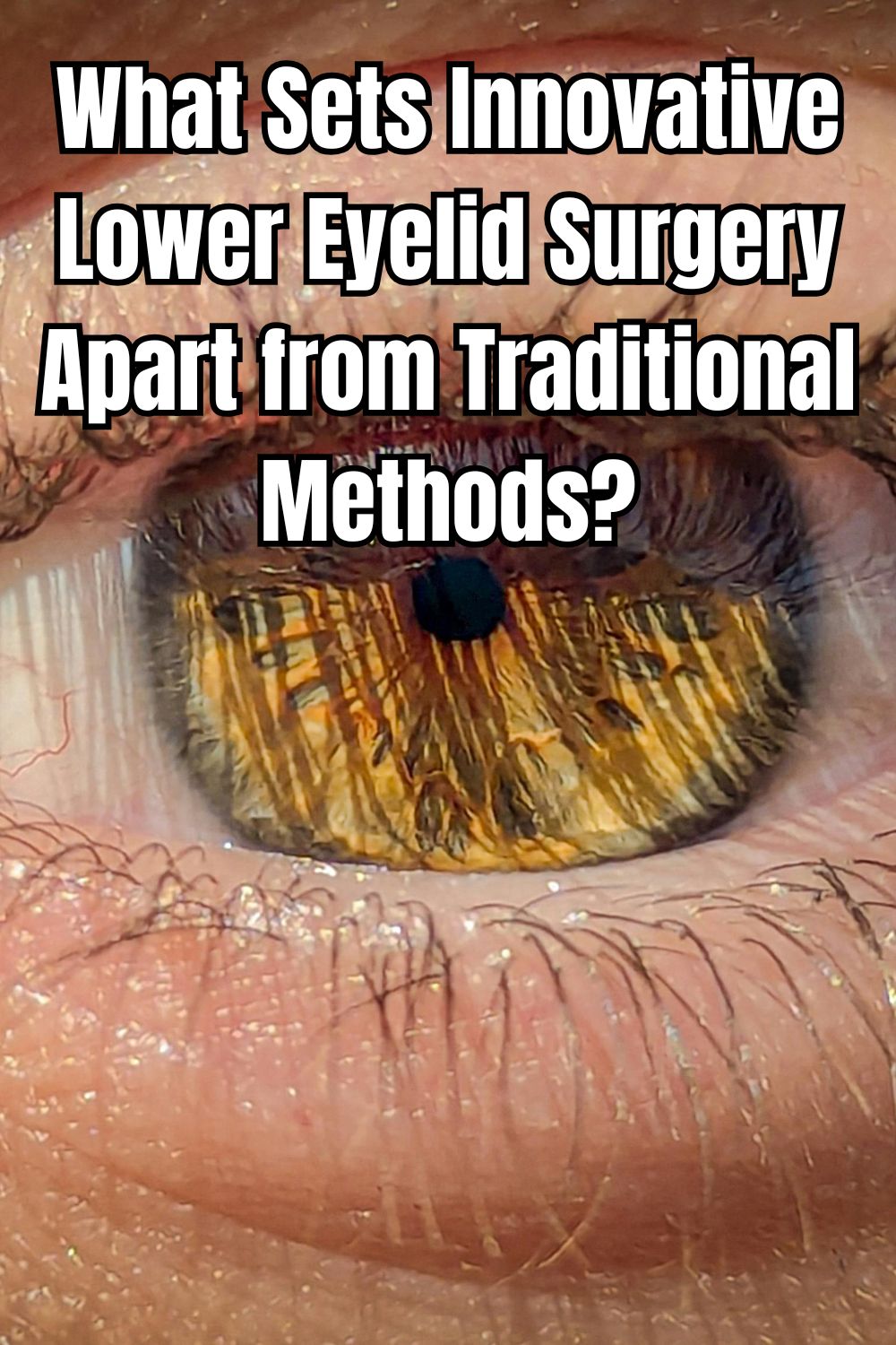 What Sets Innovative Lower Eyelid Surgery Apart from Traditional Methods