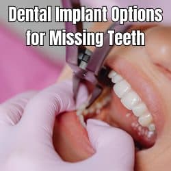 What to Know About Dental Implant Options for Missing Teeth