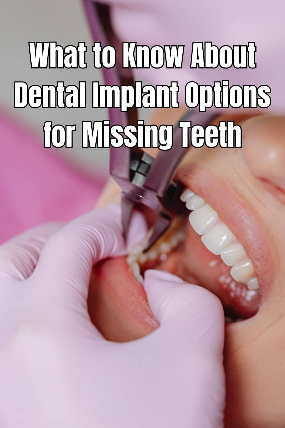 What to Know About Dental Implant Options for Missing Teeth