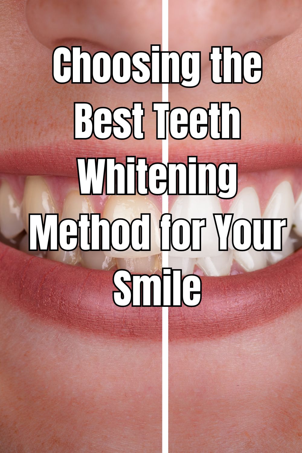 Choosing the Best Teeth Whitening Method for Your Smile