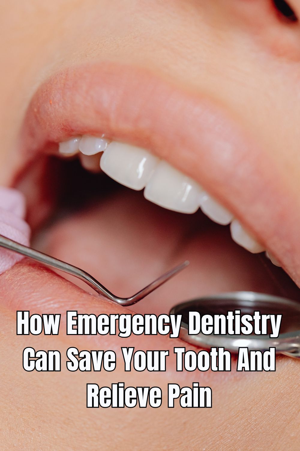 How Emergency Dentistry Can Save Your Tooth And Relieve Pain