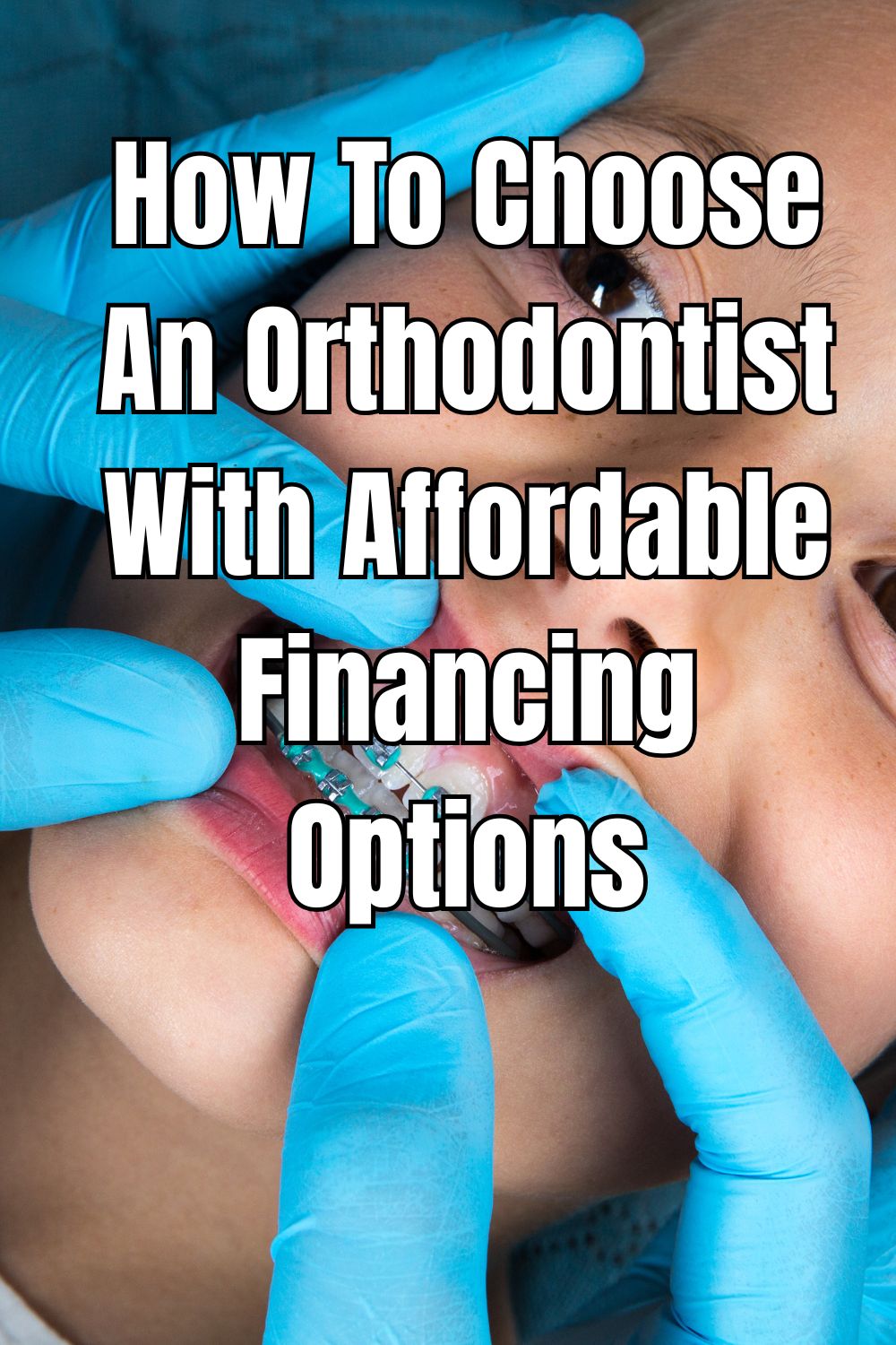 How To Choose An Orthodontist With Affordable Financing Options