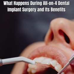 What Happens During All-on-4 Dental Implant Surgery and Its Benefits