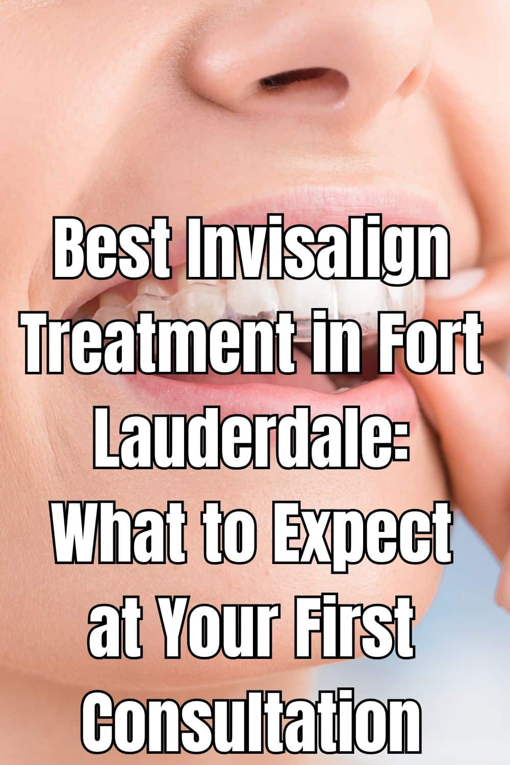 Best Invisalign Treatment in Fort Lauderdale What to Expect at Your First Consultation (2)