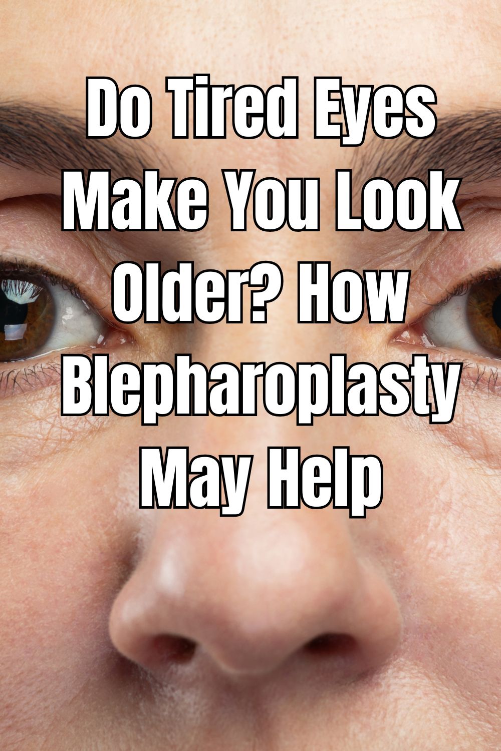 Wondering if tired eyes make you look older? Explore how blepharoplasty may help rejuvenate your appearance.