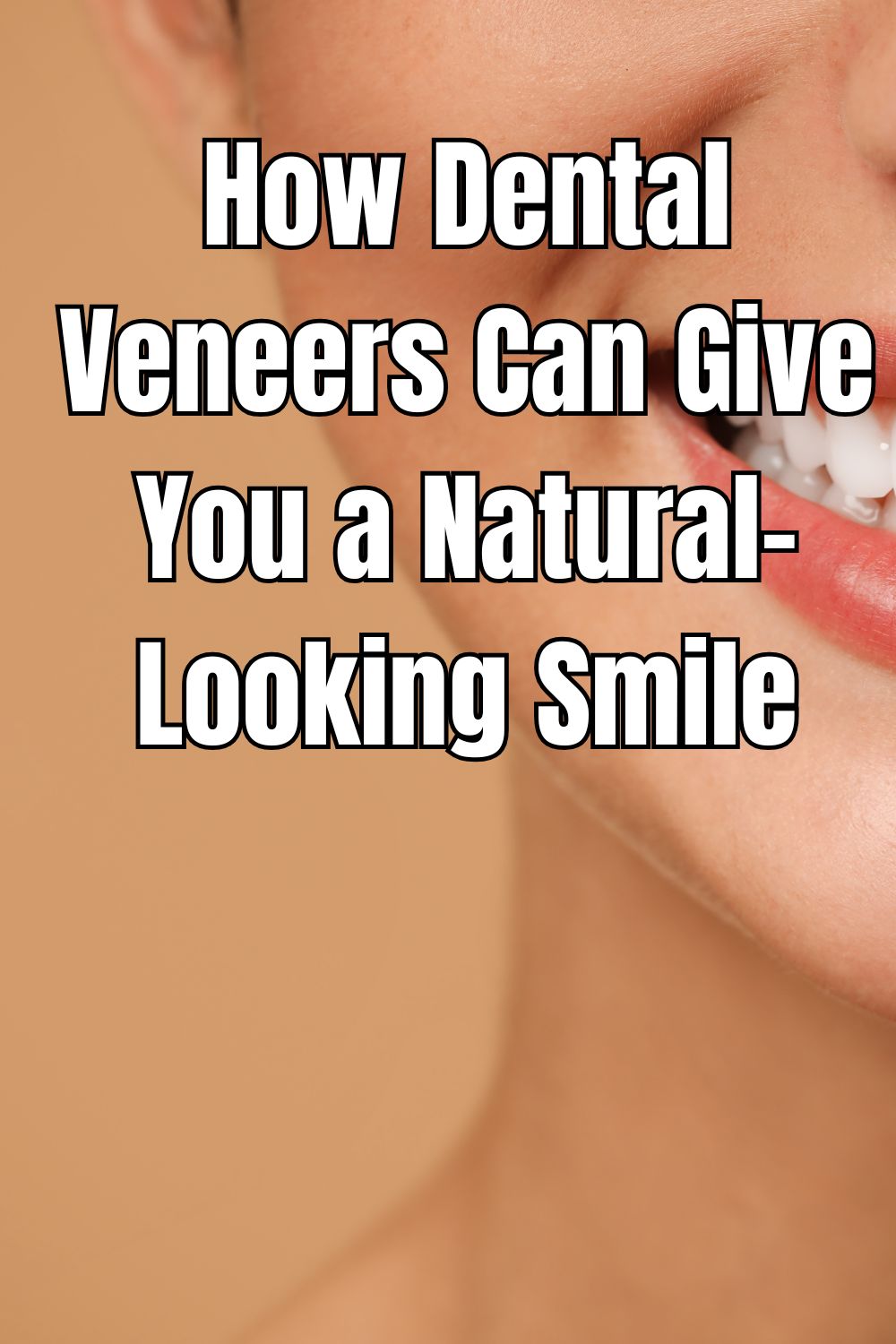 How Dental Veneers Can Give You a Natural-Looking Smile