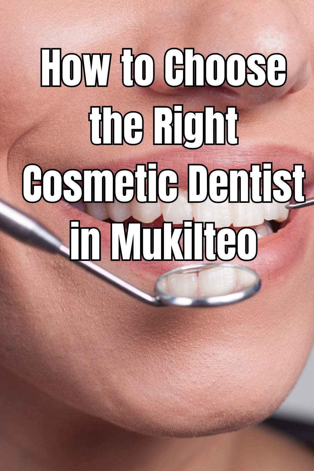 How to Choose the Right Cosmetic Dentist in Mukilteo