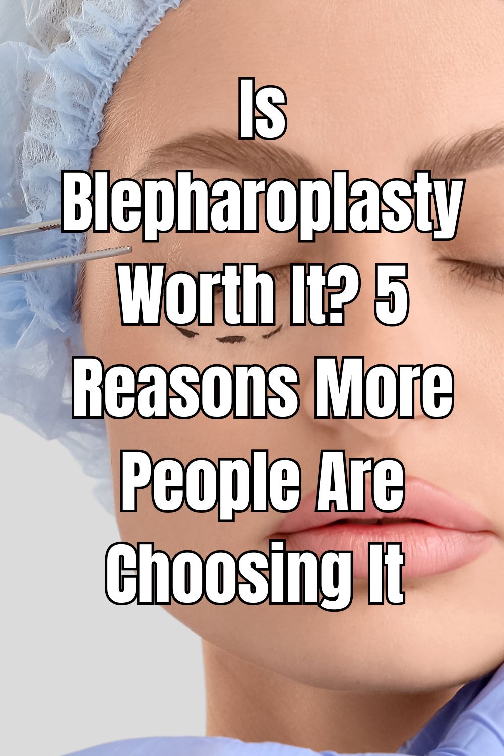 Is Blepharoplasty Worth It 5 Reasons More People Are Choosing It
