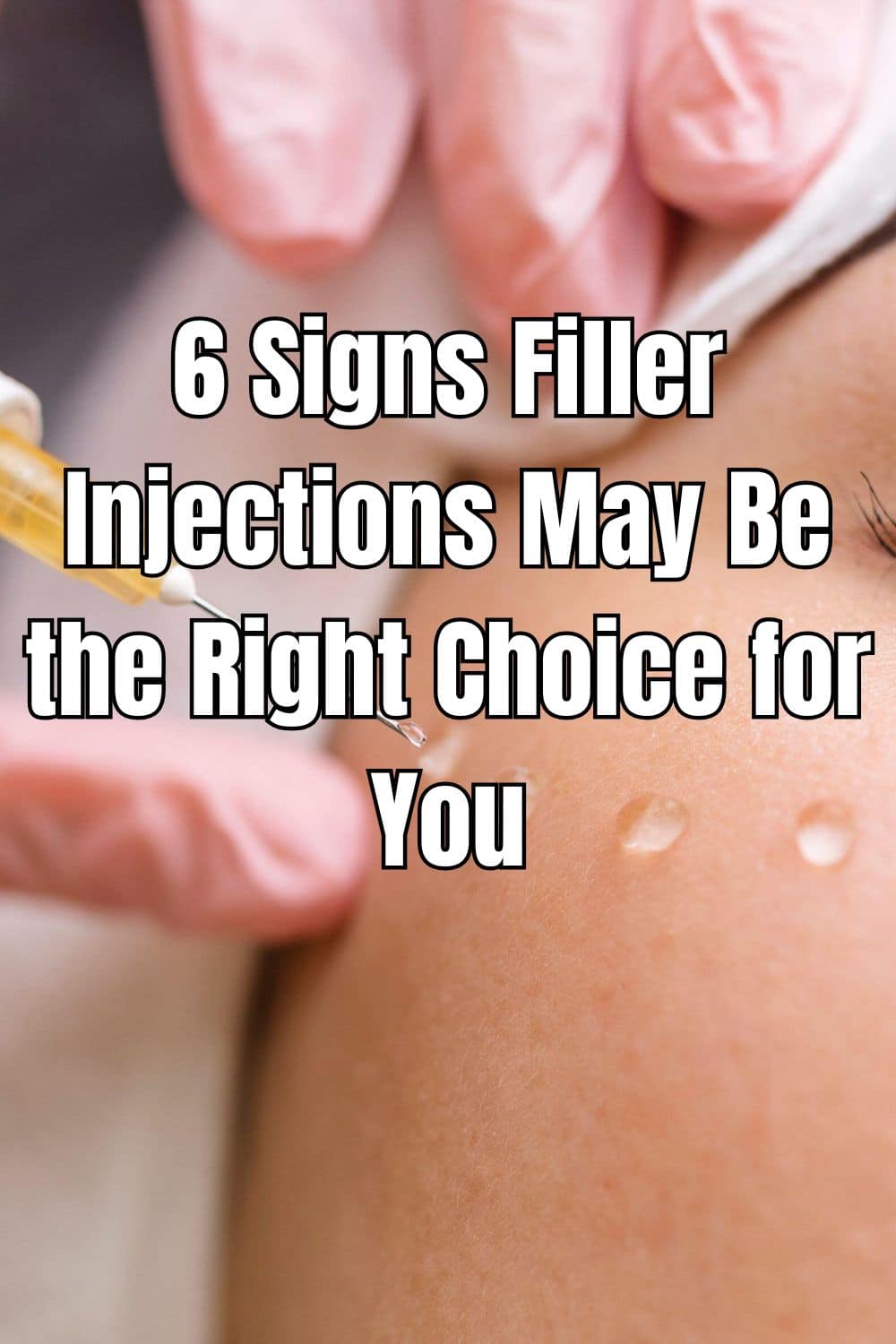 6 Signs Filler Injections May Be the Right Choice for You