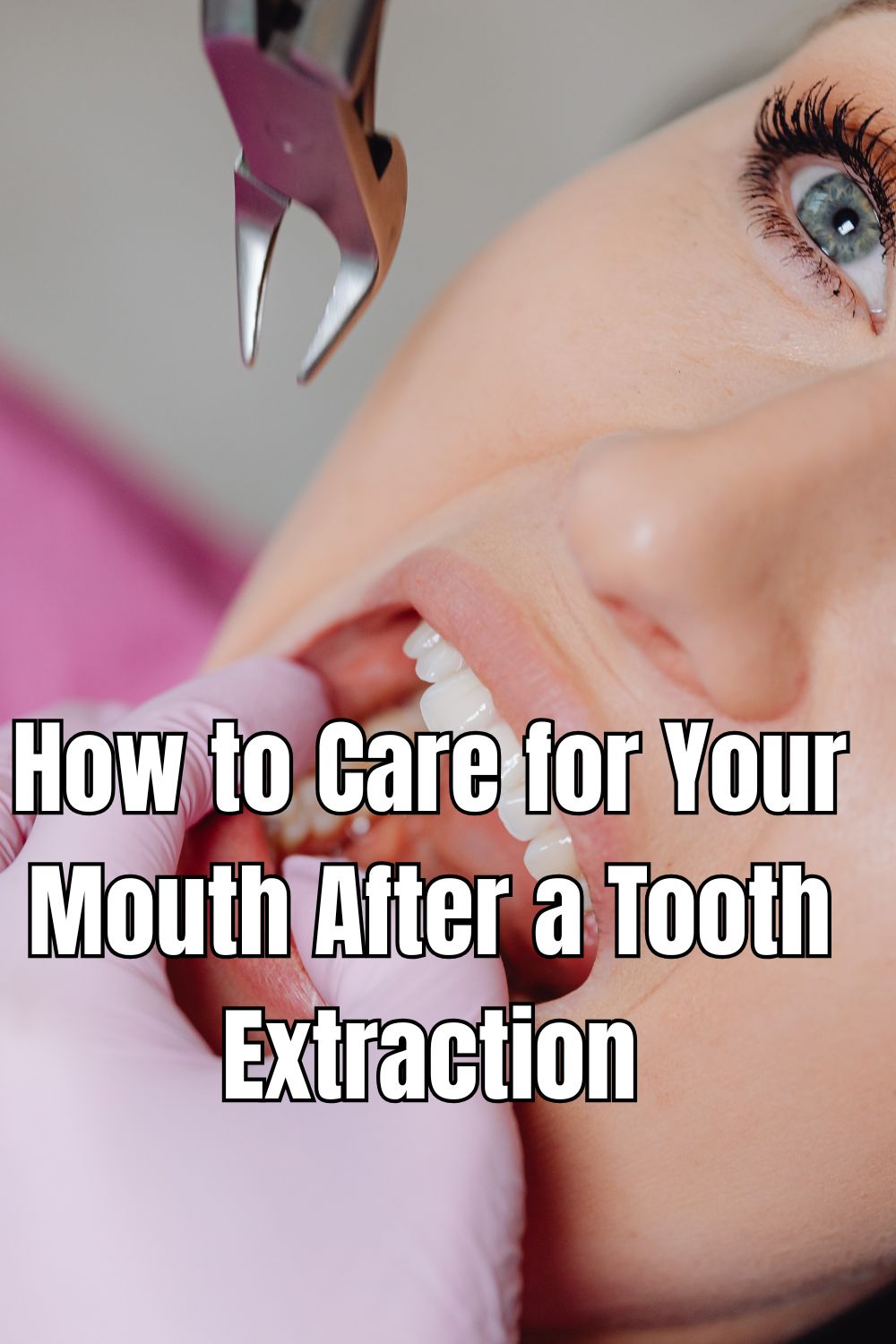 How to Care for Your Mouth After a Tooth Extraction